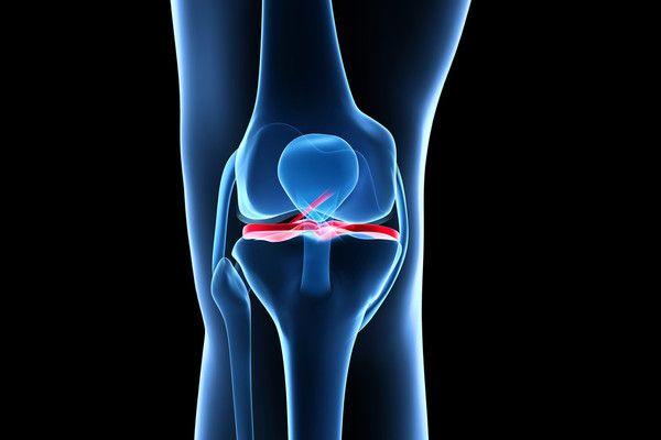 The Infamous Pop: How to Find Effective Treatment for ACL Tear