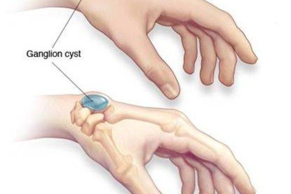 The World Of A Phillies Doctor: Treating A Common Baseball Side Effect