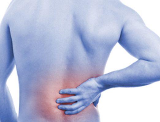Top 3 Causes & Treatment Options for Back Stiffness