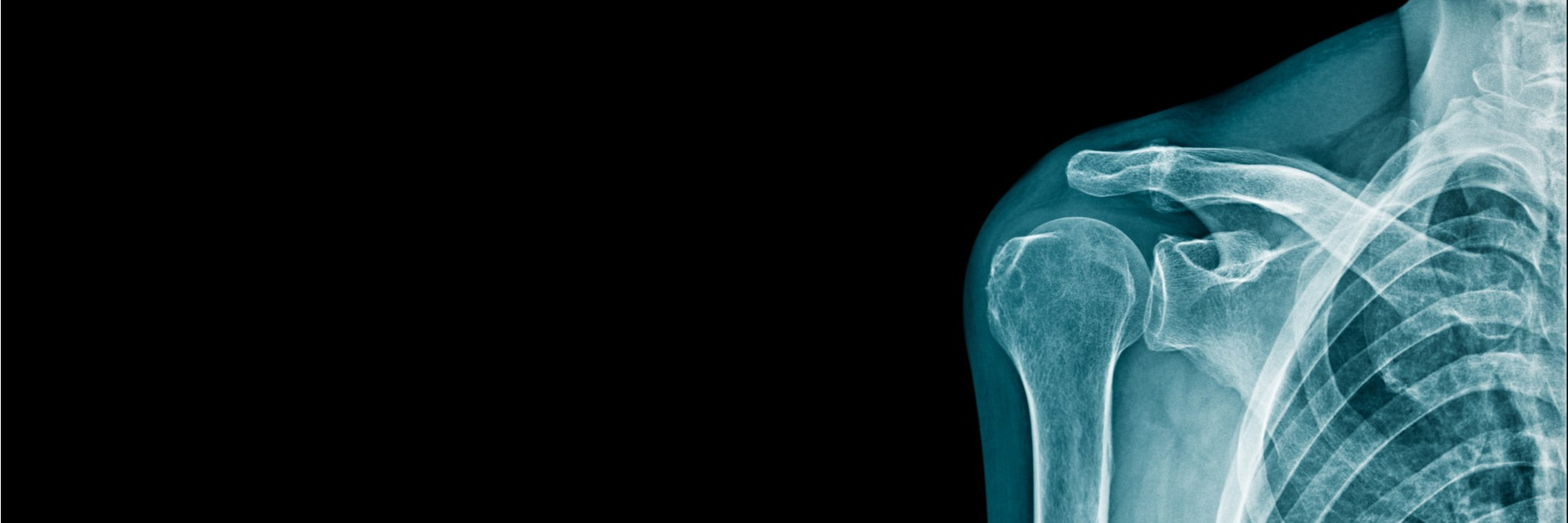 Shoulder Pain: Causes & Solutions