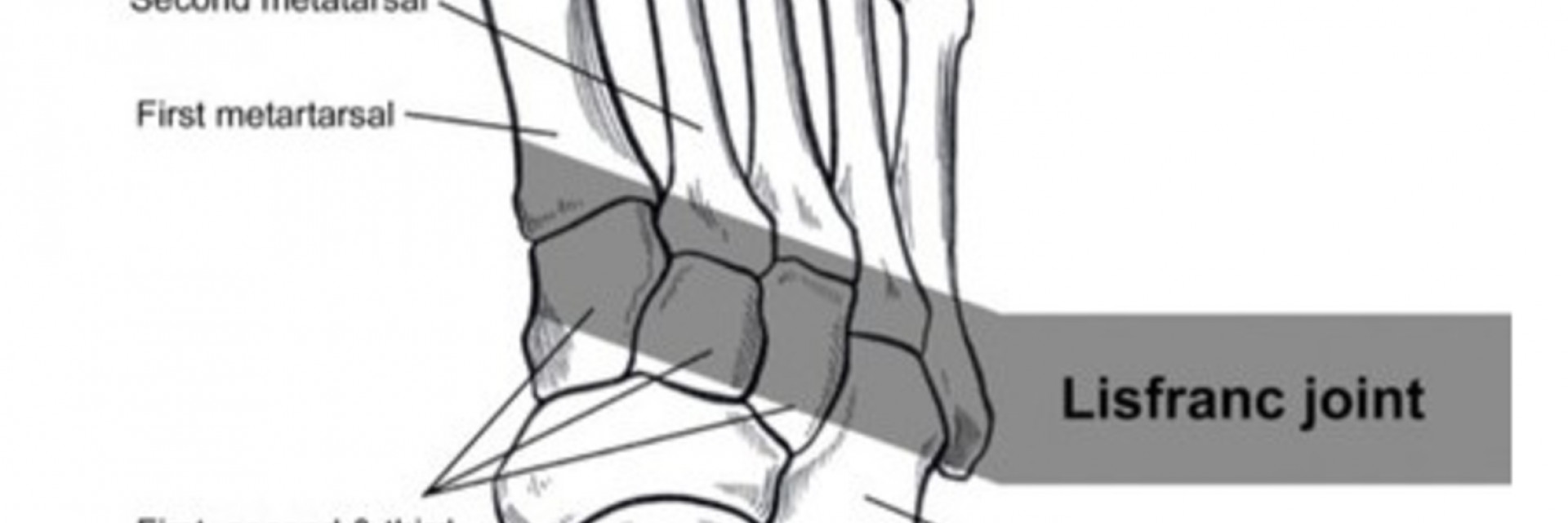 More bad news for the Jets