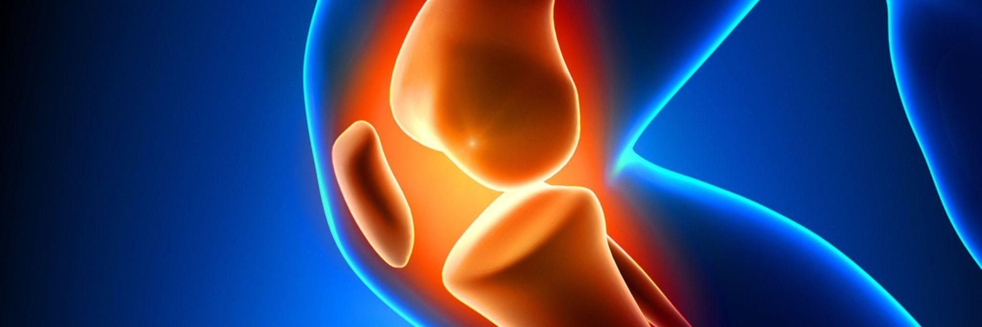 Back to Basics With Anatomy 101: What is Arthritis of the Knee?