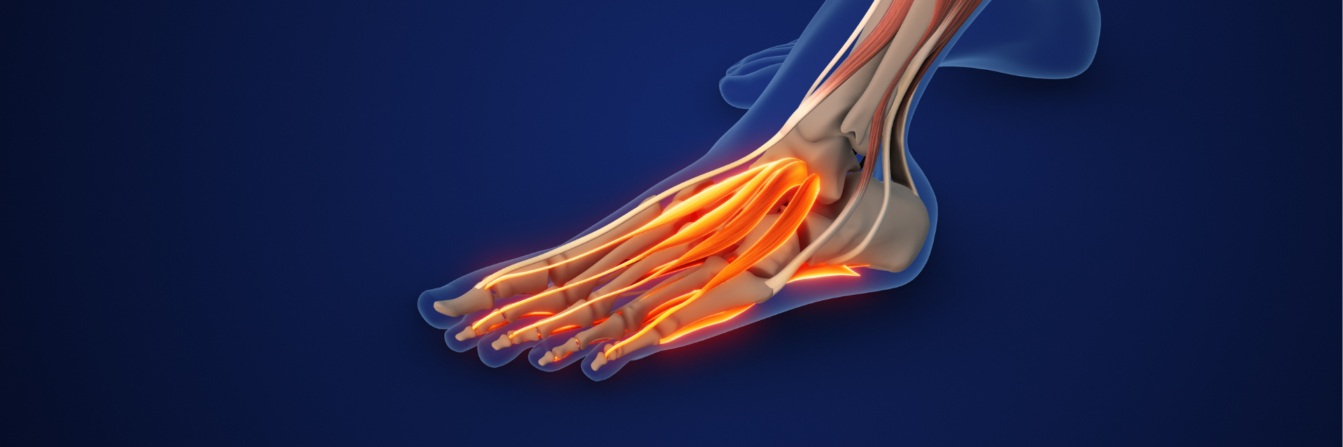 Exploring Innovative Foot Care: The Tenex Procedure for Plantar Fasciitis and Plantar Fascia Tears