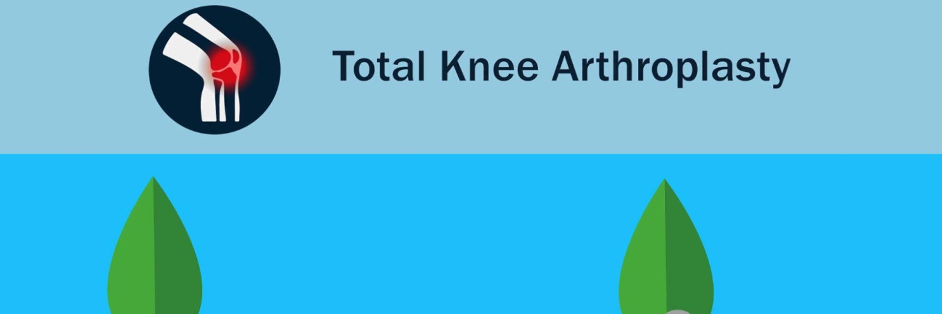 Journal of Bone and Joint Surgery: Total Knee Arthroplasty